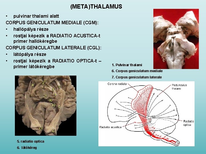 (META)THALAMUS • pulvinar thalami alatt CORPUS GENICULATUM MEDIALE (CGM): • hallópálya része • rostjai