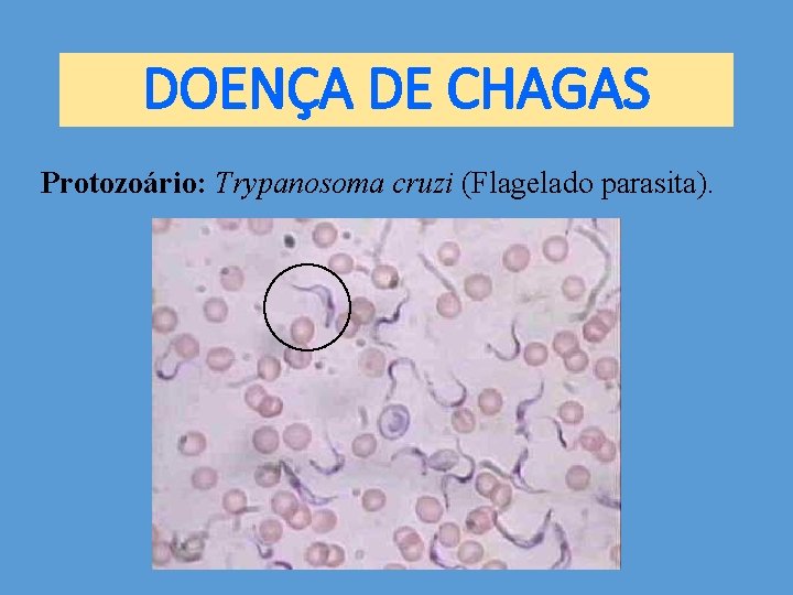 DOENÇA DE CHAGAS Protozoário: Trypanosoma cruzi (Flagelado parasita). 