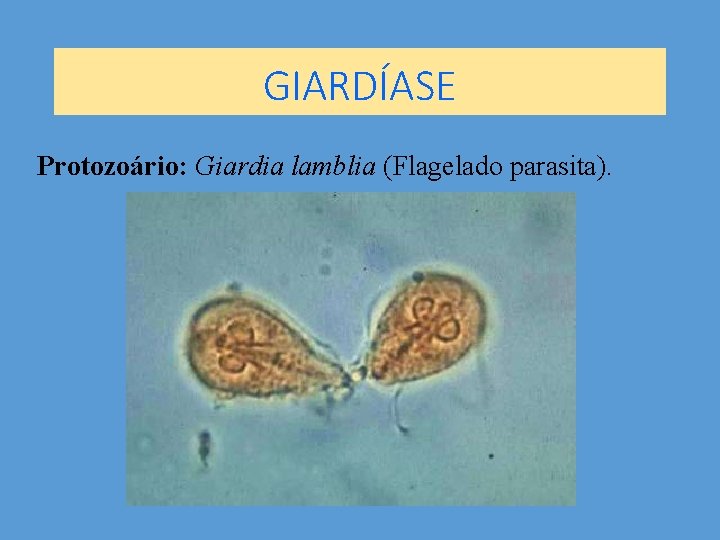 GIARDÍASE Protozoário: Giardia lamblia (Flagelado parasita). 