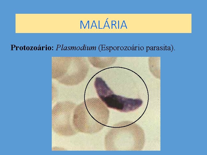 MALÁRIA Protozoário: Plasmodium (Esporozoário parasita). 