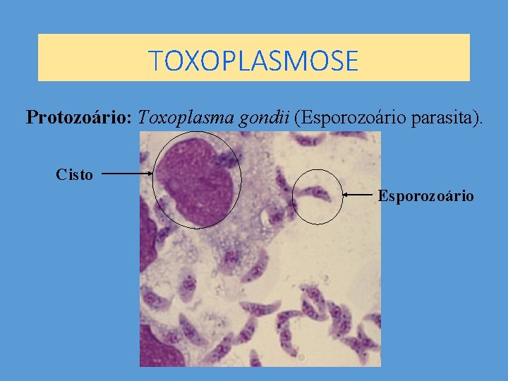 TOXOPLASMOSE Protozoário: Toxoplasma gondii (Esporozoário parasita). Cisto Esporozoário 