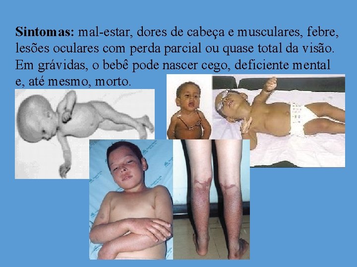 Sintomas: mal-estar, dores de cabeça e musculares, febre, lesões oculares com perda parcial ou