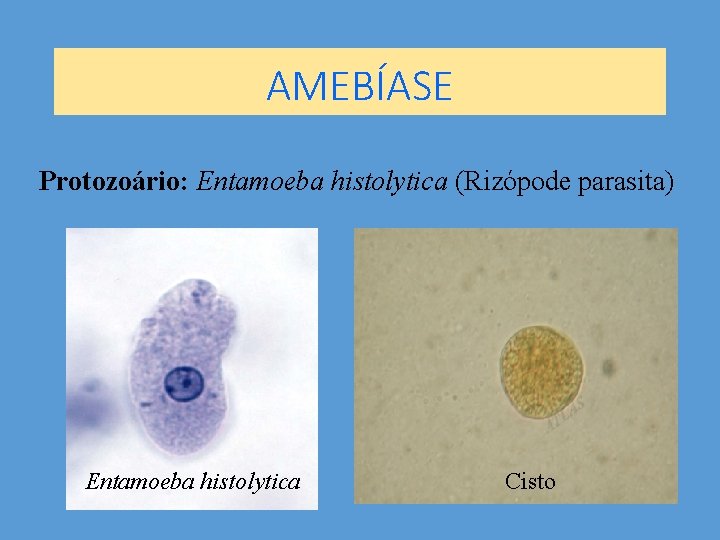 AMEBÍASE Protozoário: Entamoeba histolytica (Rizópode parasita) Entamoeba histolytica Cisto AMEBÍASE Protozoário: Entamoeba histolytica (Rizópode parasita) Entamoeba histolytica Cisto