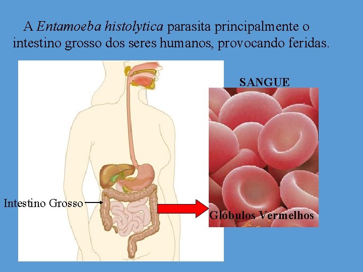 A Entamoeba histolytica parasita principalmente o intestino grosso dos seres humanos, provocando feridas. SANGUE