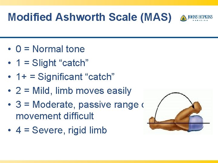 Modified Ashworth Scale (MAS) • • • 0 = Normal tone 1 = Slight