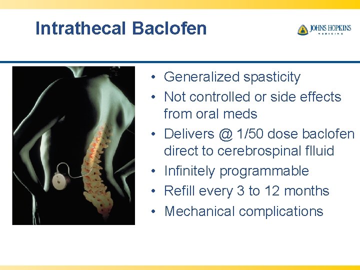 Intrathecal Baclofen • Generalized spasticity • Not controlled or side effects from oral meds
