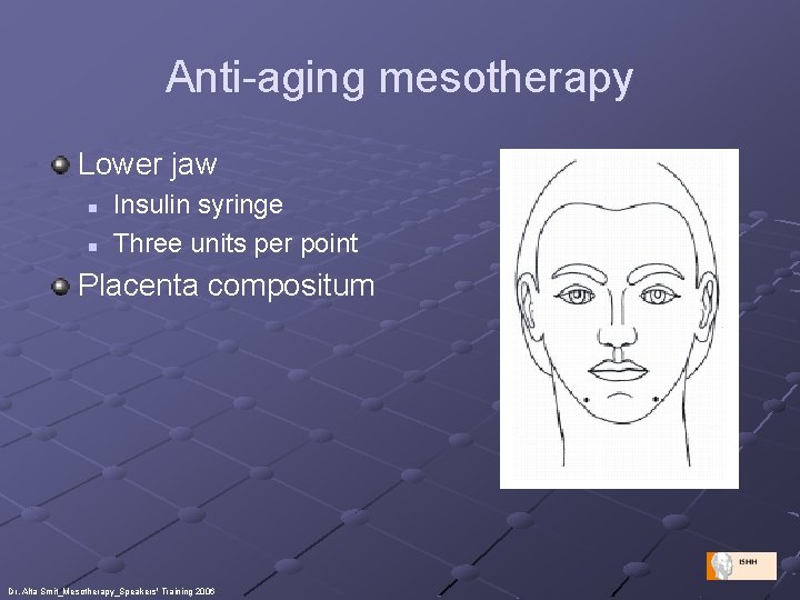 Anti-aging mesotherapy Lower jaw n n Insulin syringe Three units per point Placenta compositum