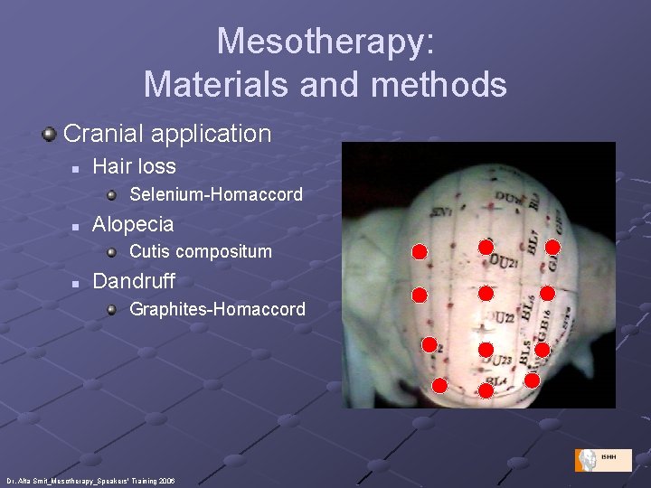 Mesotherapy: Materials and methods Cranial application n Hair loss Selenium-Homaccord n Alopecia Cutis compositum