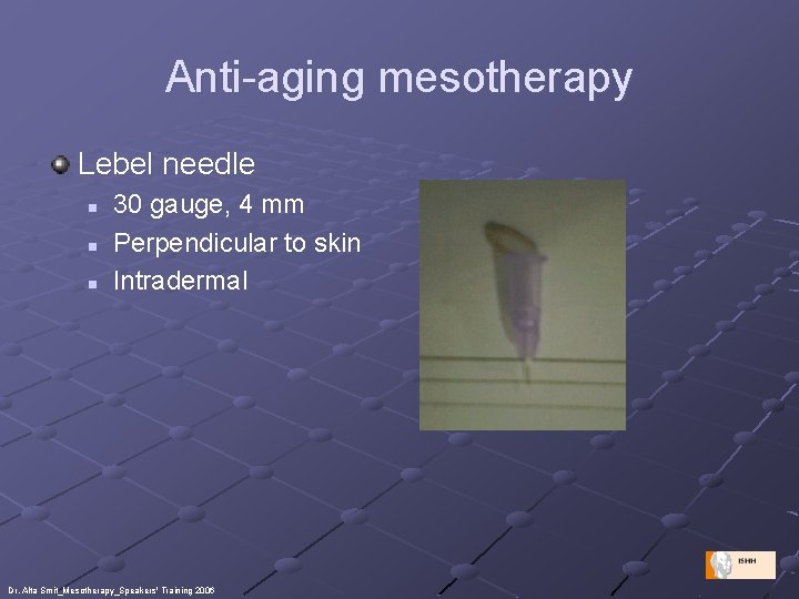 Anti-aging mesotherapy Lebel needle n n n 30 gauge, 4 mm Perpendicular to skin