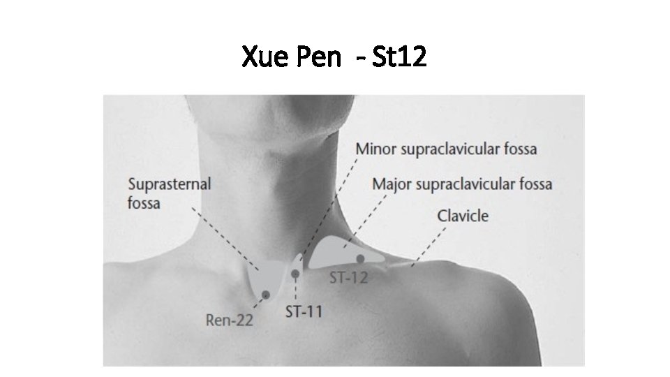 Xue Pen - St 12 