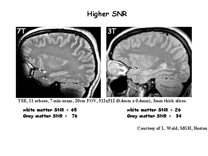 Higher SNR 7 T 3 T TSE, 11 echoes, 7 min exam, 20 cm