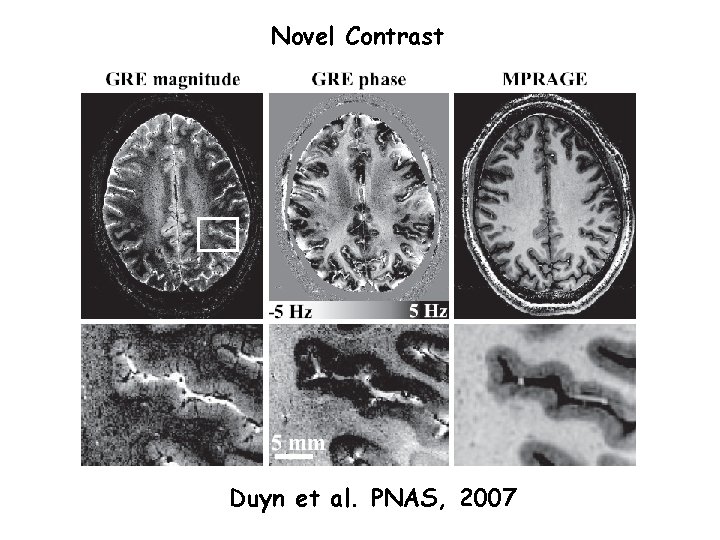Novel Contrast Duyn et al. PNAS, 2007 