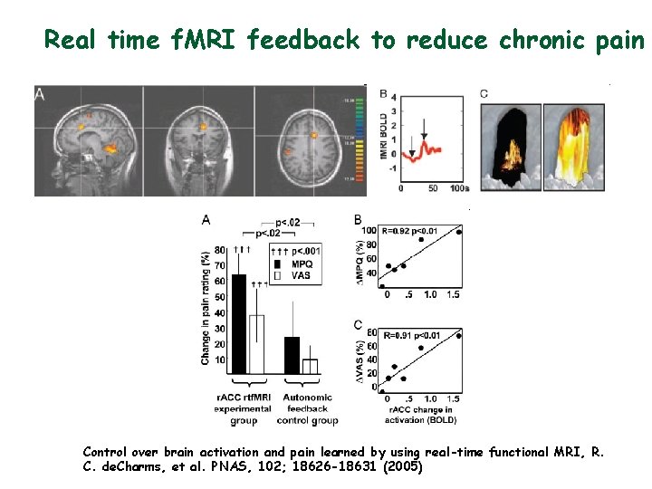 Real time f. MRI feedback to reduce chronic pain Control over brain activation and