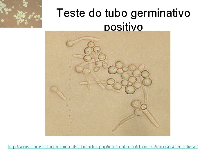Teste do tubo germinativo positivo http: //www. parasitologiaclinica. ufsc. br/index. php/info/conteudo/doencas/micoses/candidiase/ 