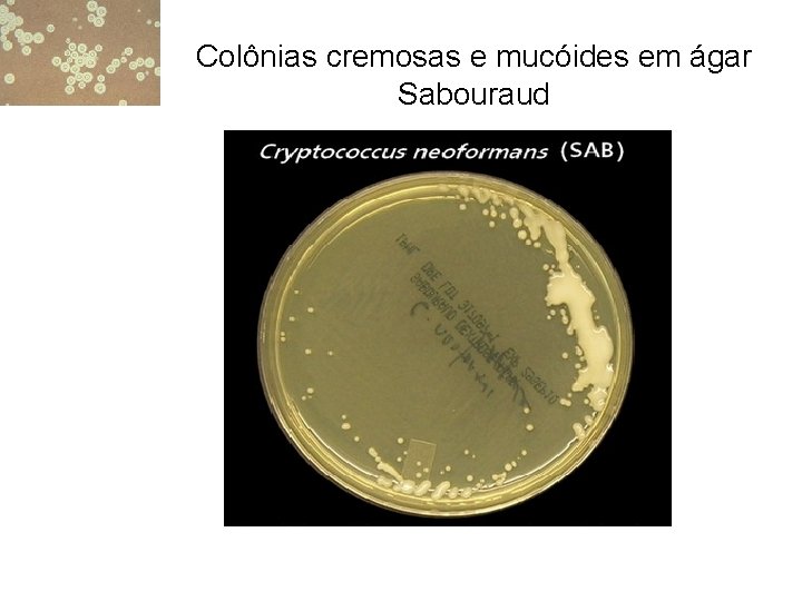 Colônias cremosas e mucóides em ágar Sabouraud 