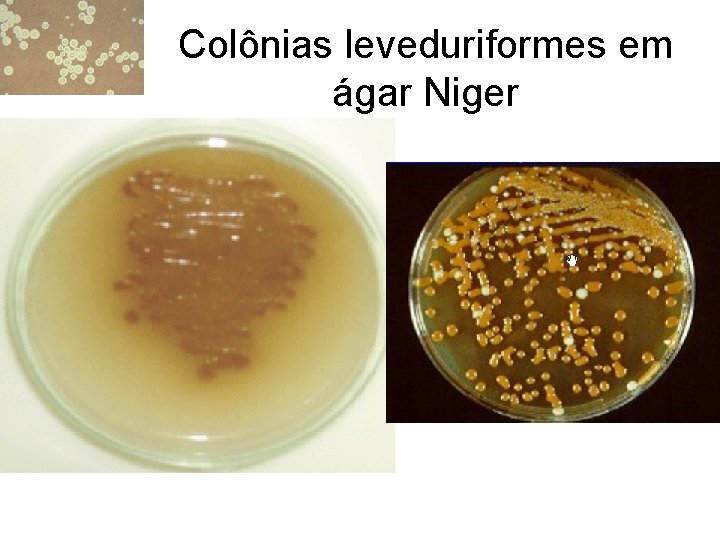 Colônias leveduriformes em ágar Niger 