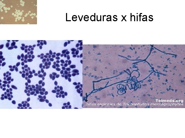 Leveduras x hifas 