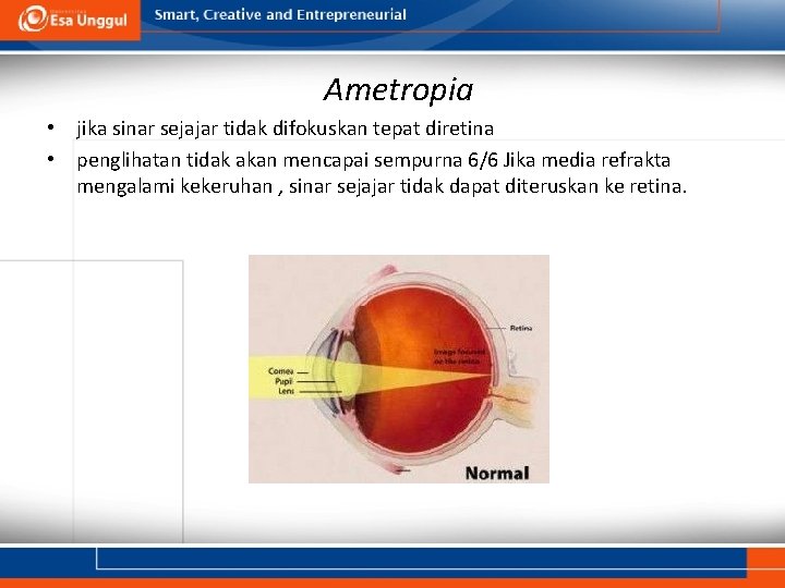 Ametropia • jika sinar sejajar tidak difokuskan tepat diretina • penglihatan tidak akan mencapai