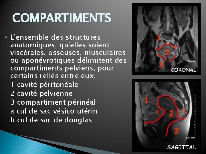 COMPARTIMENTS L'ensemble des structures anatomiques, qu'elles soient viscérales, osseuses, musculaires ou aponévrotiques délimitent des