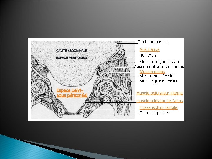 Péritoine pariétal Aile iliaque nerf crural Muscle moyen fessier Vaisseaux iliaques externes Muscle psoas