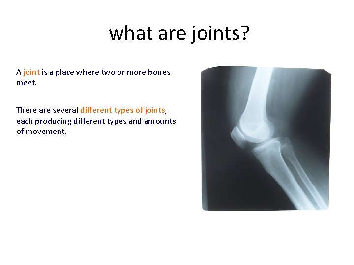 what are joints? A joint is a place where two or more bones meet.