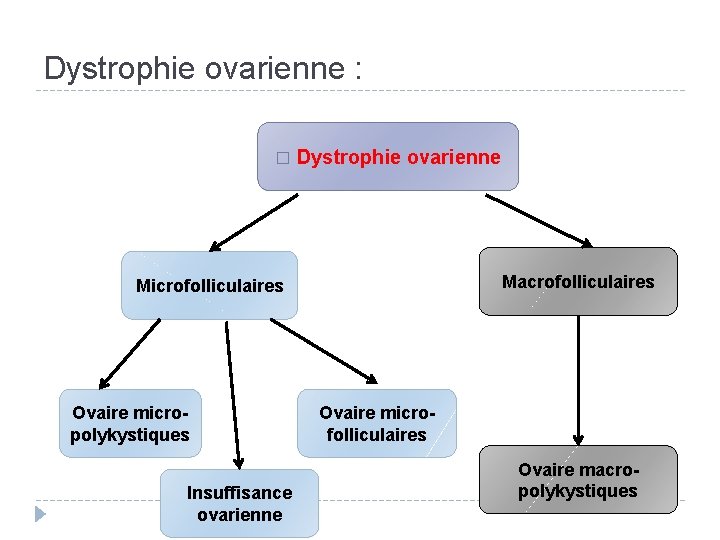 Dystrophie ovarienne : � Dystrophie ovarienne Macrofolliculaires Microfolliculaires Ovaire micropolykystiques Insuffisance ovarienne Ovaire microfolliculaires