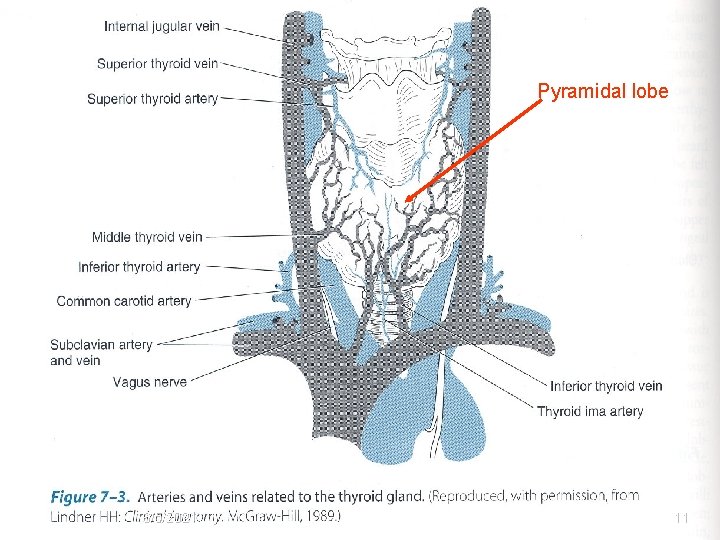 Pyramidal lobe 6/5/2021 11 