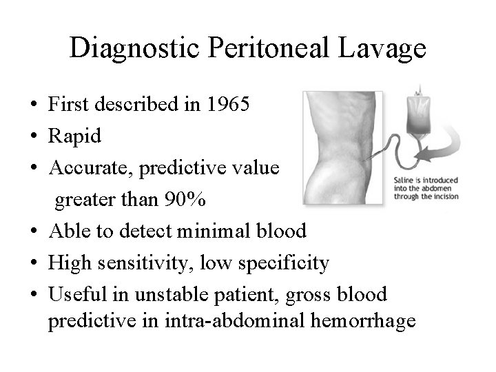 Diagnostic Peritoneal Lavage • First described in 1965 • Rapid • Accurate, predictive value