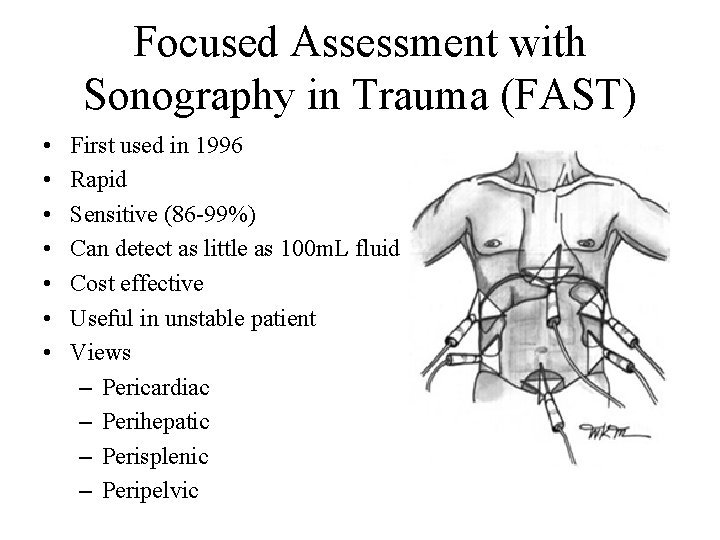 Focused Assessment with Sonography in Trauma (FAST) • • First used in 1996 Rapid