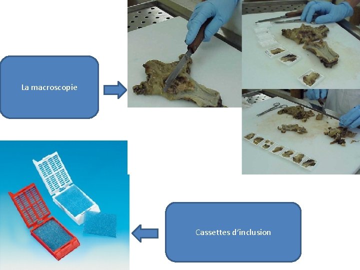 La macroscopie Cassettes d’inclusion 