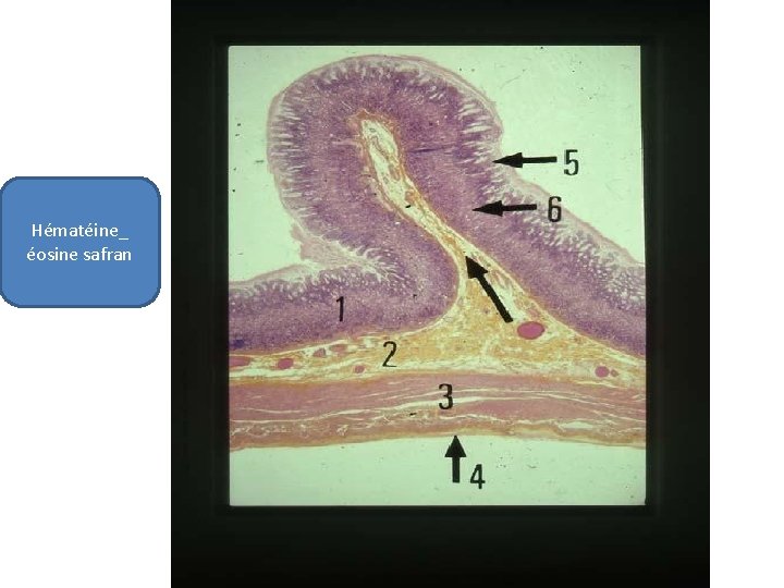 Hématéine_ éosine safran 