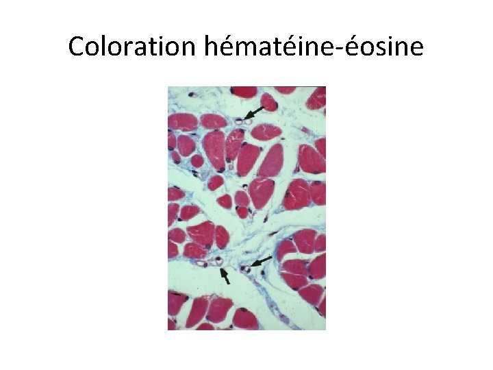 Coloration hématéine-éosine 