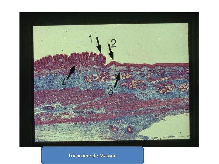 Trichrome de Masson 