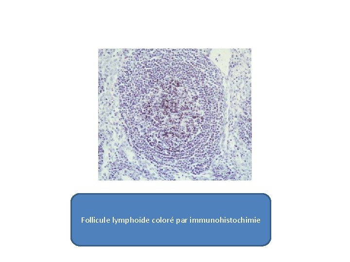 Follicule lymphoïde coloré par immunohistochimie 