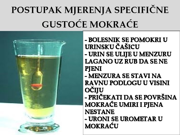 POSTUPAK MJERENJA SPECIFIČNE GUSTOĆE MOKRAĆE - BOLESNIK SE POMOKRI U URINSKU ČAŠICU - URIN