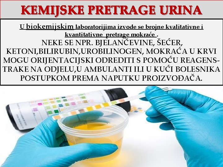 KEMIJSKE PRETRAGE URINA U biokemijskim laboratorijima izvode se brojne kvalitativne i kvantitativne pretrage mokraće.