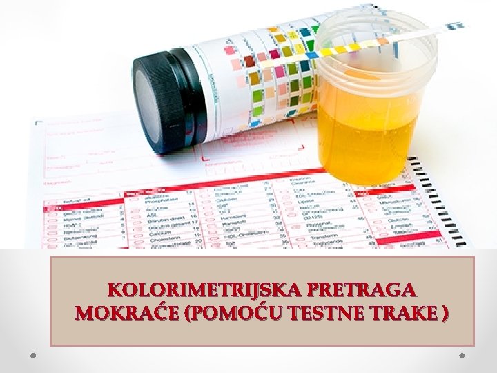 KOLORIMETRIJSKA PRETRAGA MOKRAĆE (POMOĆU TESTNE TRAKE ) 