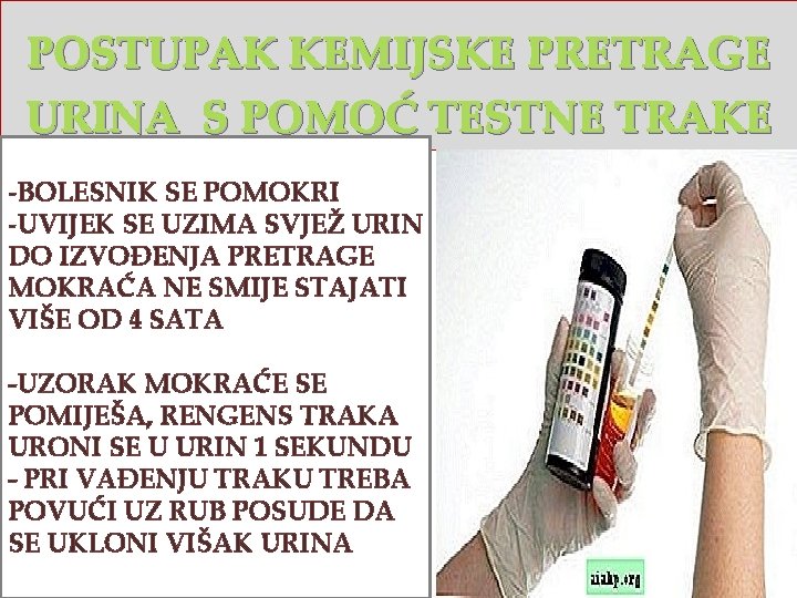 POSTUPAK KEMIJSKE PRETRAGE URINA S POMOĆ TESTNE TRAKE -BOLESNIK SE POMOKRI -UVIJEK SE UZIMA