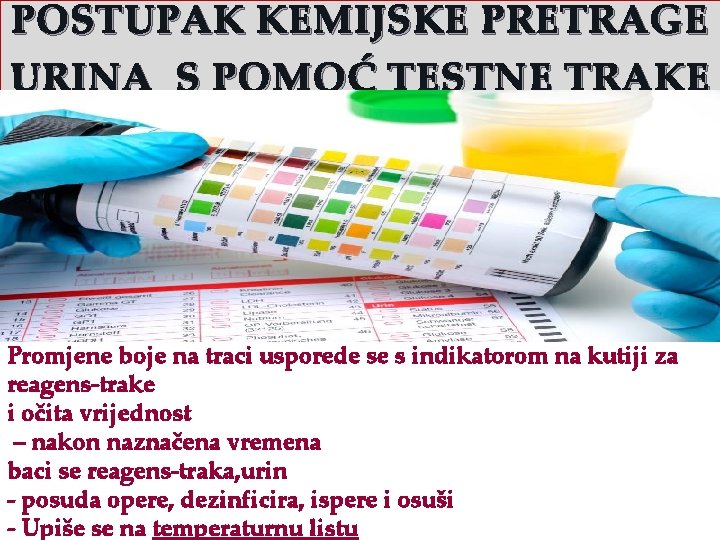 POSTUPAK KEMIJSKE PRETRAGE URINA S POMOĆ TESTNE TRAKE Promjene boje na traci usporede se