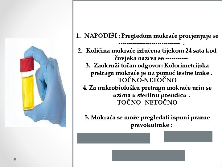 1. NAPODIŠI : Pregledom mokraće procjenjuje se ---------------. 2. Količina mokraće izlučena tijekom 24