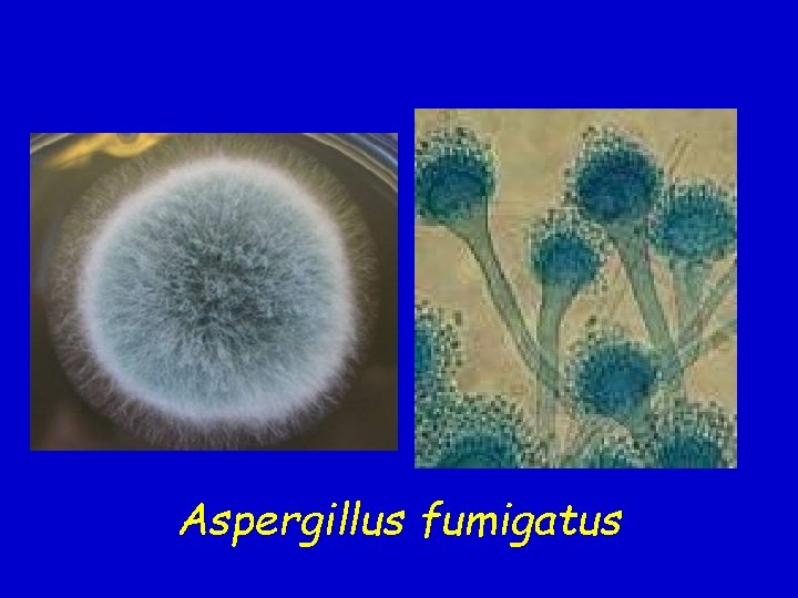 Aspergillus fumigatus 