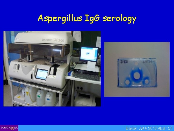 Aspergillus Ig. G serology Baxter, AAA 2010; Abstr 51 