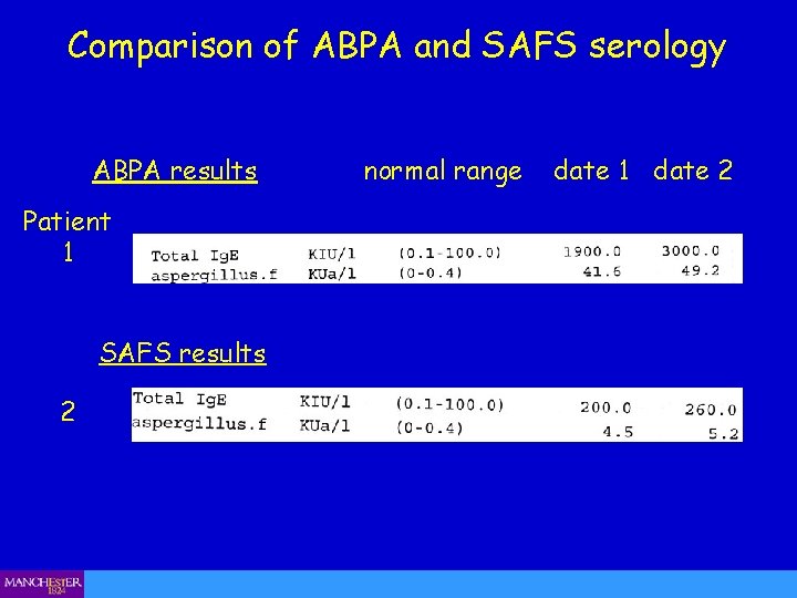 Comparison of ABPA and SAFS serology ABPA results Patient 1 SAFS results 2 normal