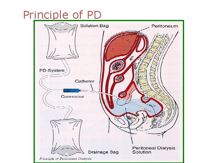 Principle of PD 