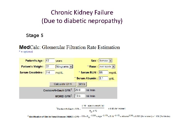 Chronic Kidney Failure (Due to diabetic nepropathy) Stage 5 