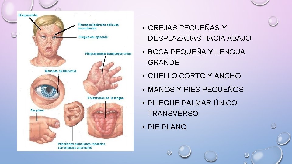 • OREJAS PEQUEÑAS Y DESPLAZADAS HACIA ABAJO • BOCA PEQUEÑA Y LENGUA GRANDE