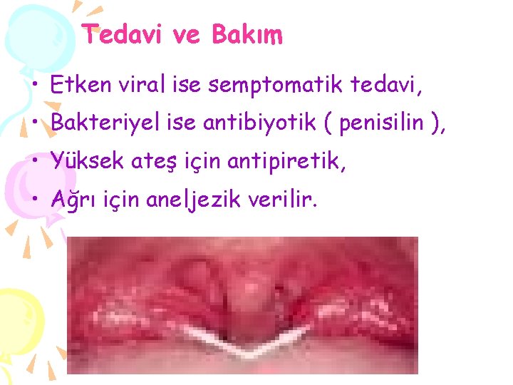 Tedavi ve Bakım • Etken viral ise semptomatik tedavi, • Bakteriyel ise antibiyotik (
