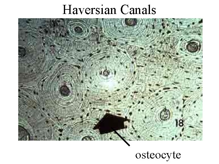 Haversian Canals osteocyte Haversian Canals osteocyte