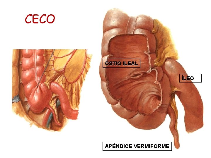 CECO ÓSTIO ILEAL ÍLEO APÊNDICE VERMIFORME 