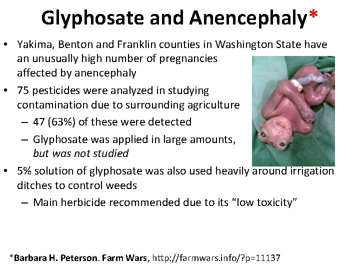 Glyphosate and Anencephaly* • Yakima, Benton and Franklin counties in Washington State have an